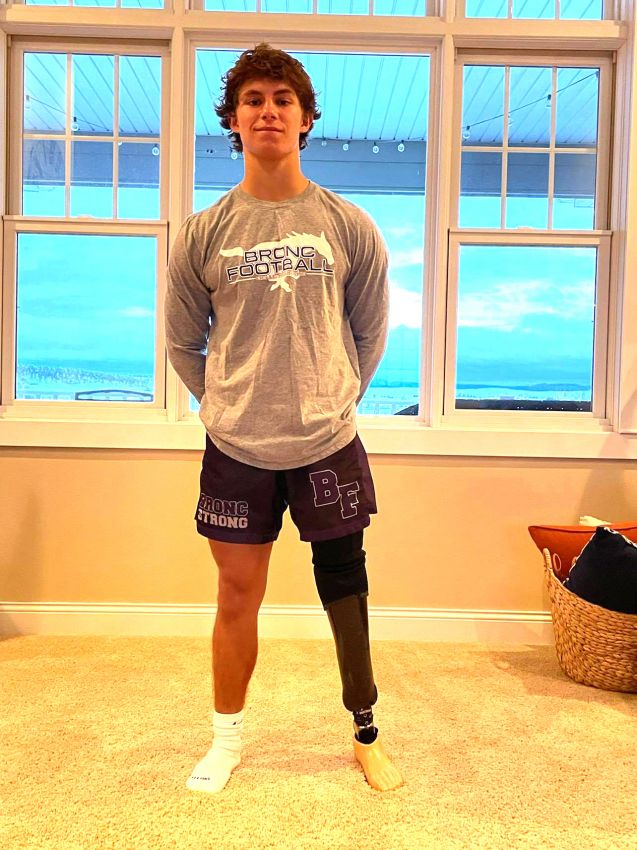 Belle Fourche's starting fullback Logan Tyndall plays with a prosthetic leg